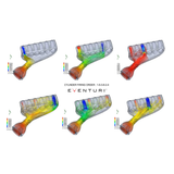 Eventuri E46 M3 Hybrid Carbon Fiber CSL Style Airbox